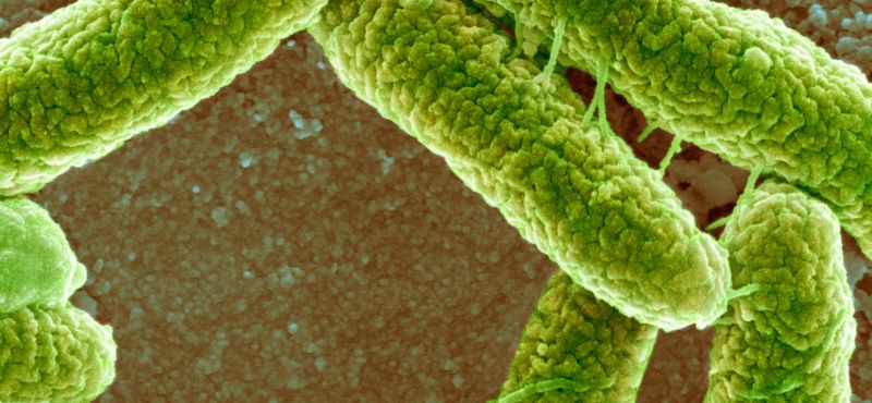 An image of e coli bacteria.